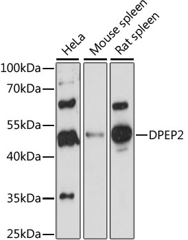 DPEP2 Rabbit pAb