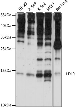 SNRNP25 Rabbit pAb