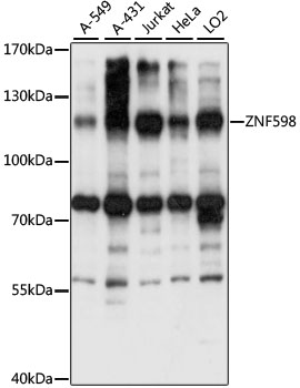 ZNF598 Rabbit pAb