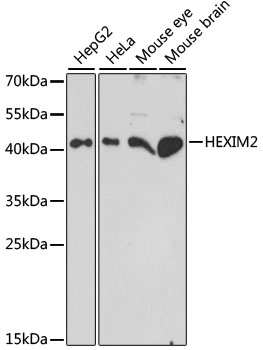 HEXIM2 Rabbit pAb