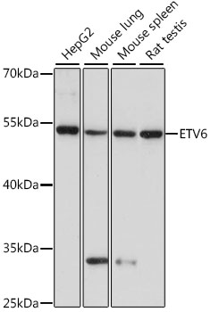 ETV6 Rabbit pAb