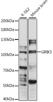 GRIK5 Rabbit pAb