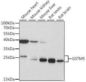 GSTM5 Rabbit pAb