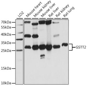 GSTT2 Rabbit pAb