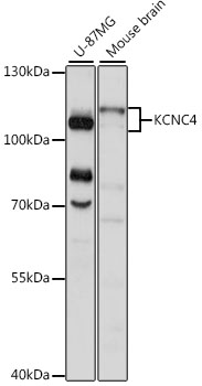KCNC4 Rabbit pAb