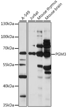 PGM3 Rabbit pAb