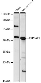 PRPSAP1 Rabbit pAb