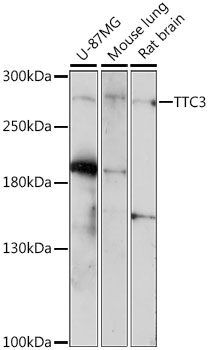 TTC3 Rabbit pAb