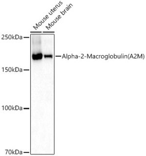 Alpha-2-Macroglobulin (A2M) Rabbit pAb