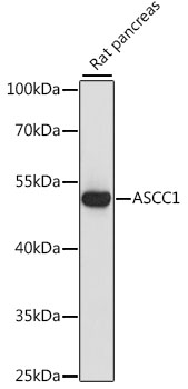 ASCC1 Rabbit pAb