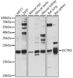 DCTN5 Rabbit pAb