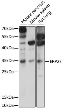 ERP27 Rabbit pAb