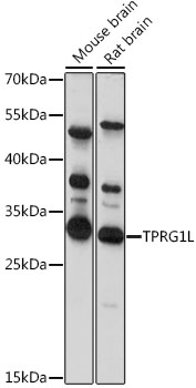 TPRG1L Rabbit pAb