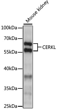CERKL Rabbit pAb