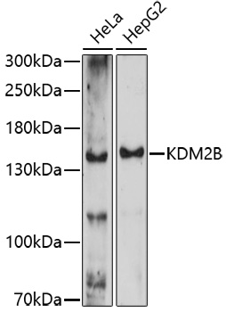 KDM2B Rabbit pAb