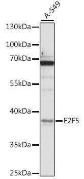 E2F5 Rabbit pAb