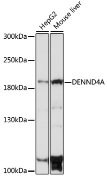 DENND4A Rabbit pAb