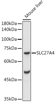 FATP4/SLC27A4 Rabbit pAb