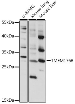 TMEM176B Rabbit pAb