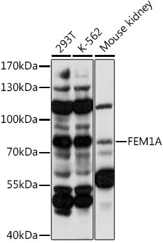 FEM1A Rabbit pAb
