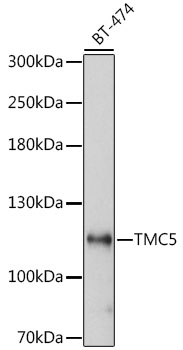 TMC5 Rabbit pAb