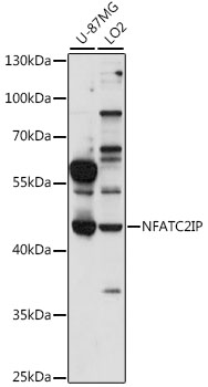 NFATC2IP Rabbit pAb