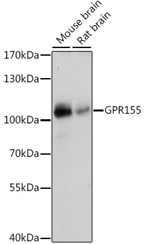 GPR155 Rabbit pAb