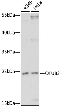 OTUB2 Rabbit pAb