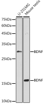 BDNF Rabbit pAb