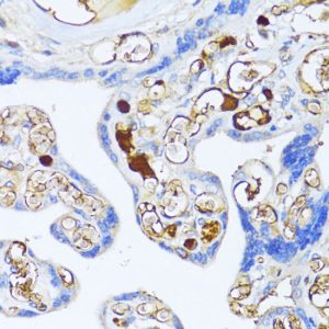 Alpha-2-Macroglobulin (A2M) Rabbit pAb