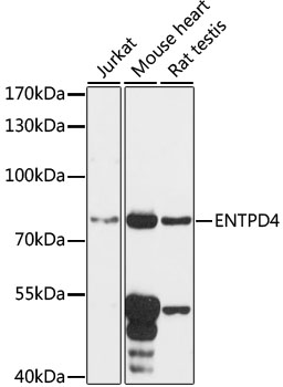 ENTPD4 Rabbit pAb