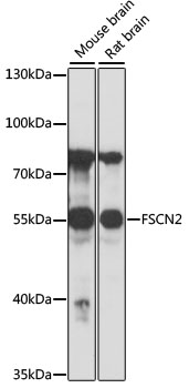 FSCN2 Rabbit pAb