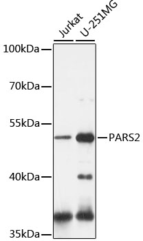 PARS2 Rabbit pAb