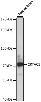 CRTAC1 Rabbit pAb
