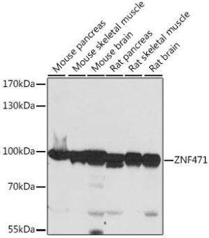 ZNF471 Rabbit pAb