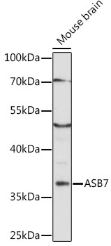 ASB7 Rabbit pAb