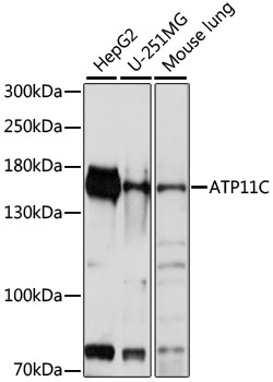 ATP11C Rabbit pAb
