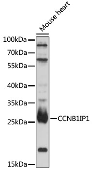 CCNB1IP1 Rabbit pAb