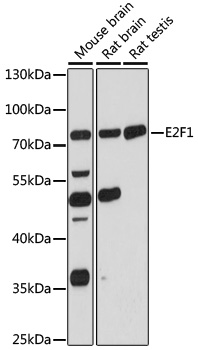 E2F1 Rabbit pAb