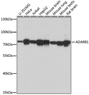 ADARB1 Rabbit pAb