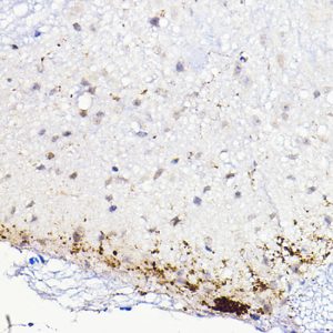 CALCA Rabbit pAb