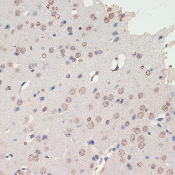 NEUROD1 Rabbit pAb