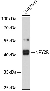 NPY2R Rabbit pAb