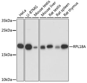 RPL18A Rabbit pAb