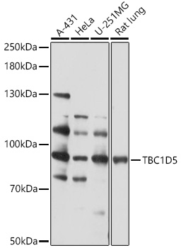 TBC1D5 Rabbit pAb