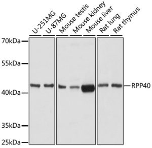 RPP40 Rabbit pAb