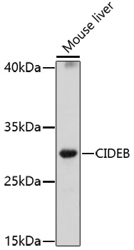 CIDEB Rabbit pAb