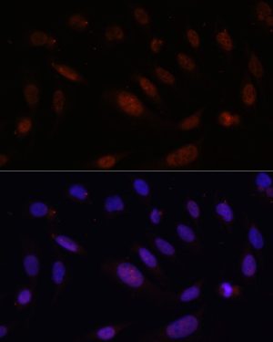 Bcl9 Rabbit pAb