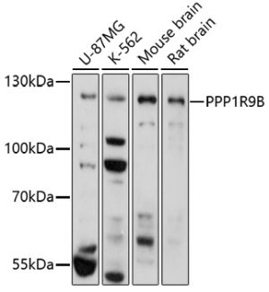PPP1R9B Rabbit pAb