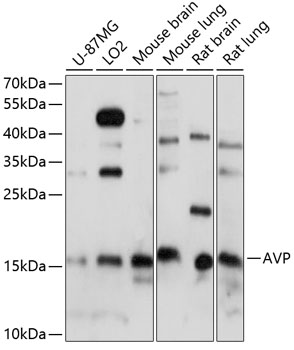 AVP Rabbit pAb